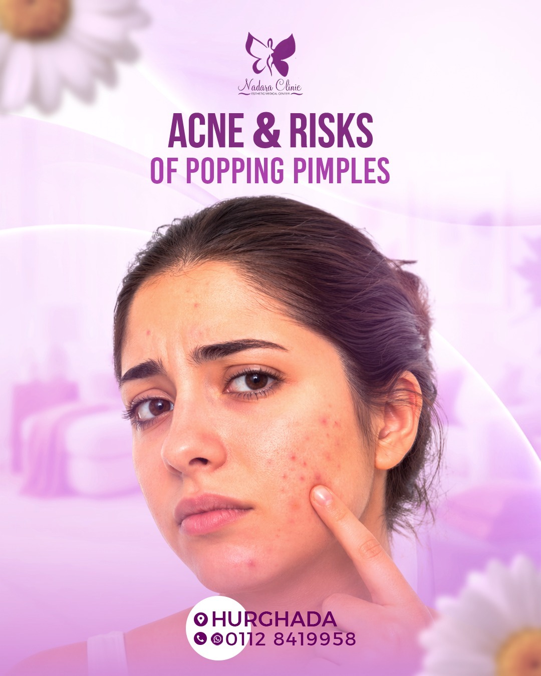 Acne and the risks of squeezing it in Hurghada